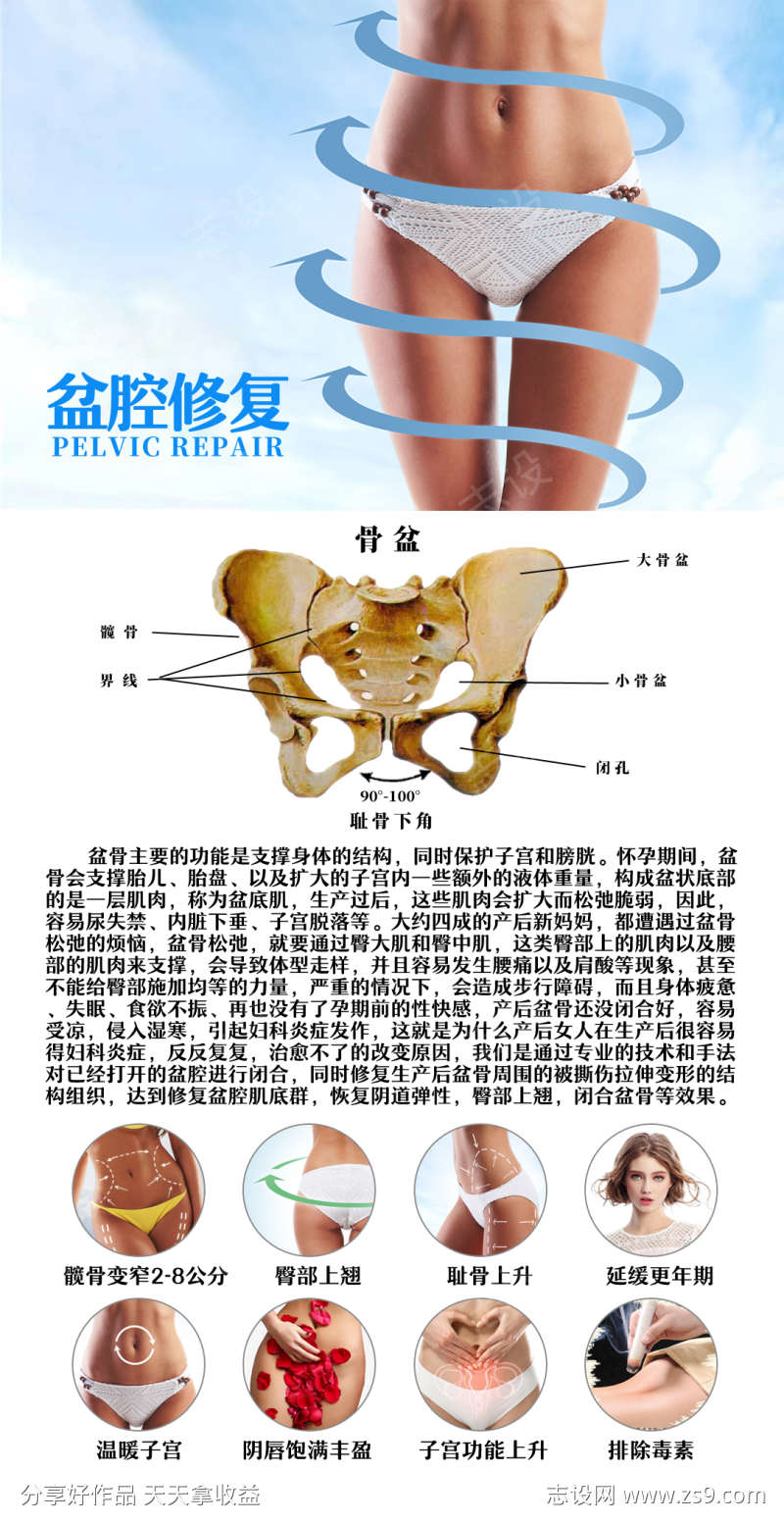 盆腔修复