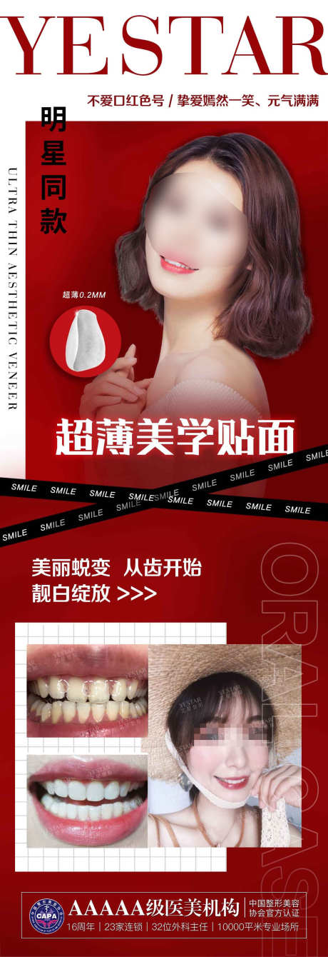 医美口腔宣传图_源文件下载_PSD格式_1352X3937像素-人物,宣传,口腔,贴面,医美,海报-作品编号:2023060417309647-设计素材-www.shejisc.cn