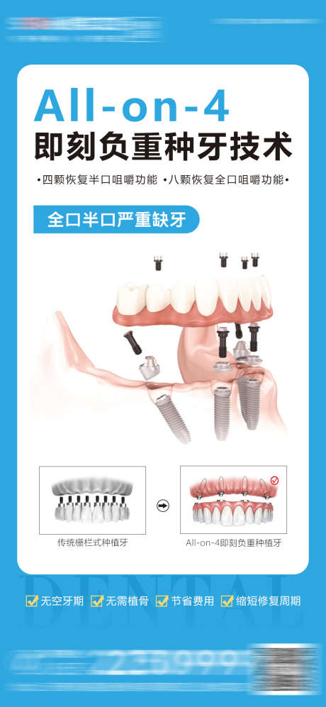 医美口腔种植牙海报_源文件下载_PSD格式_1080X2341像素-宣传,对比图,简约,大气,牙齿,即刻负重,齿科,牙科,海报,种植牙,口腔,医美-作品编号:2023061217568358-设计素材-www.shejisc.cn