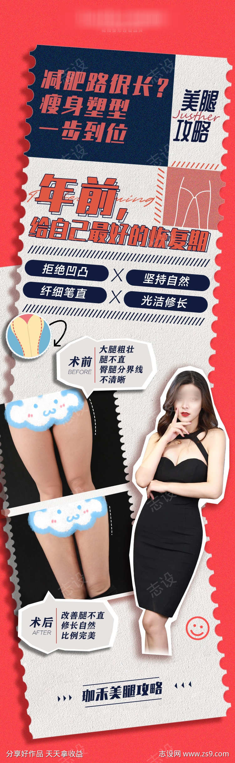 医美抽脂案例图