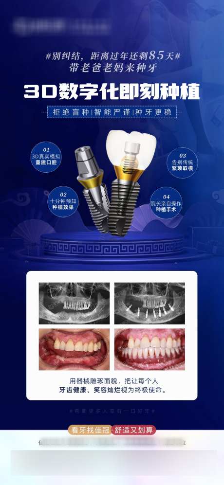 种植牙海报_源文件下载_PSD格式_1080X2340像素-牙科,对比,案例,简约,种植牙,数字化,口腔,医疗,海报-作品编号:2023122810165493-设计素材-www.shejisc.cn