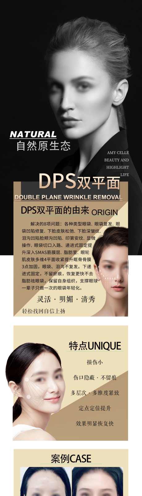 DPS双平面提升_源文件下载_PSD格式_2714X11425像素-除皱,品项,抗衰,年轻化,提升,拉皱,医美-作品编号:2024022010422974-志设-zs9.com