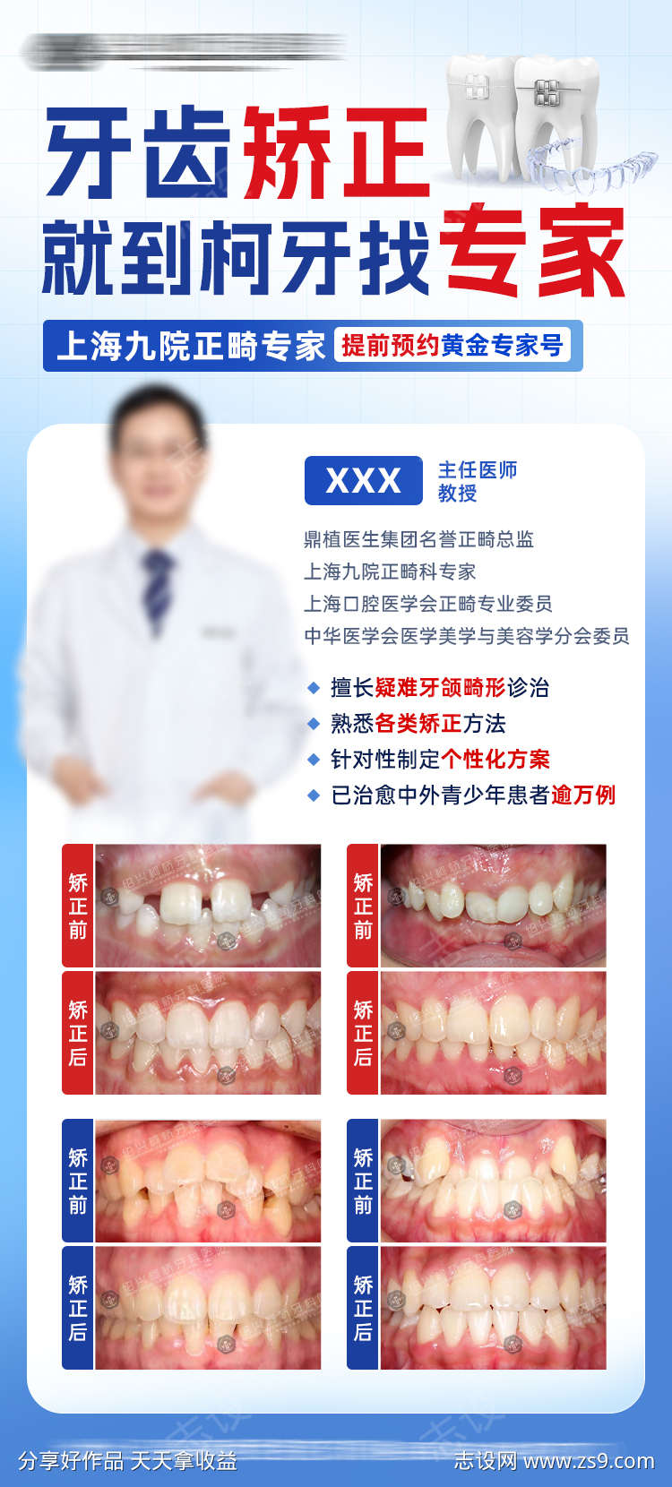 牙齿矫正专家海报正畸案例对比图