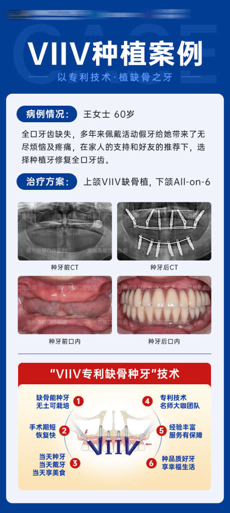 全口种植牙案例对比图海报_源文件下载_PSD格式_750X1670像素-医疗,牙科,口腔,技术,全口种植,海报,对比,案例,种植牙-作品编号:2024032910124056-志设-zs9.com