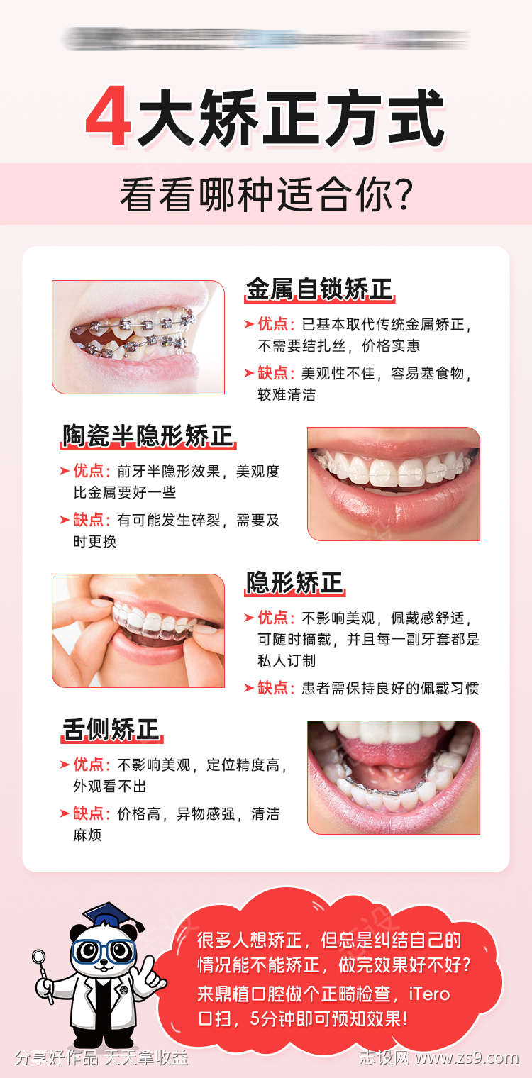 牙齿矫正牙套类型口腔科普