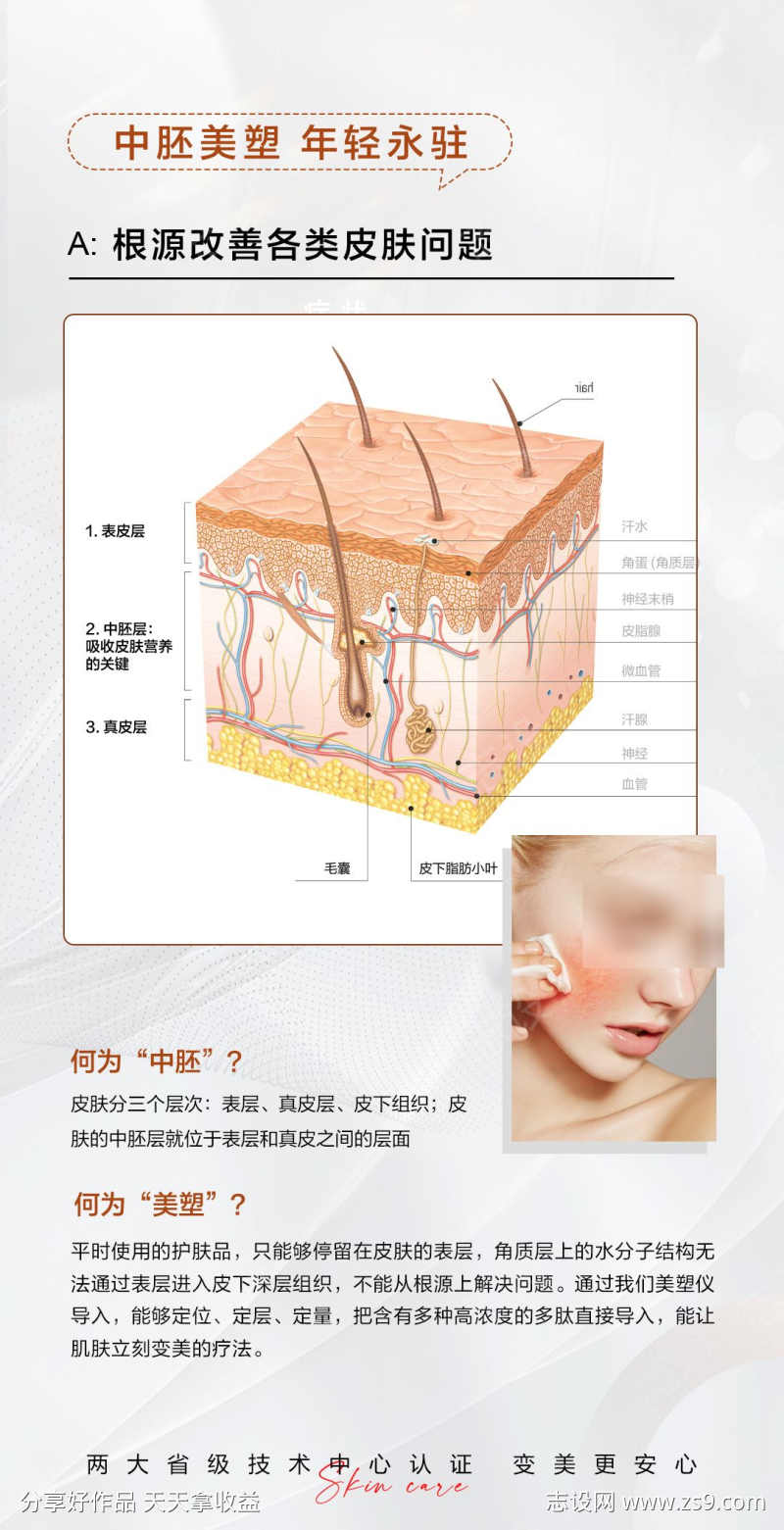 医美中胚祛皱补水皮肤结构图