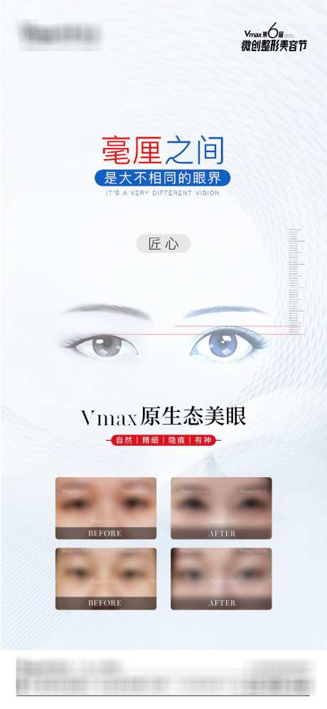 医美活动海报_源文件下载_PSD格式_1080X2340像素-匠心,案例,原生,双眼皮,眼睛,整形,整外,活动,医美-作品编号:2024100811504446-志设-zs9.com