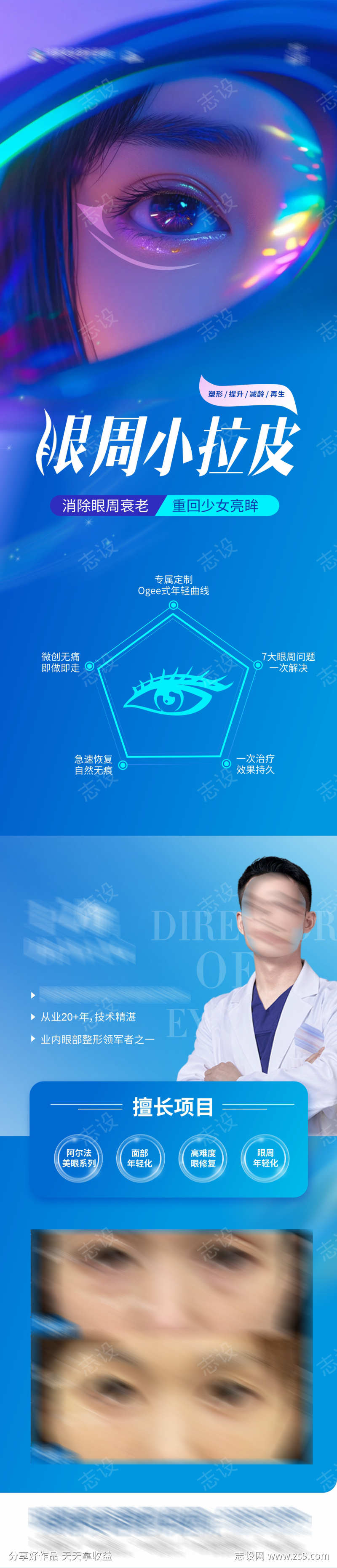 医美眼周小拉皮案例长图海报