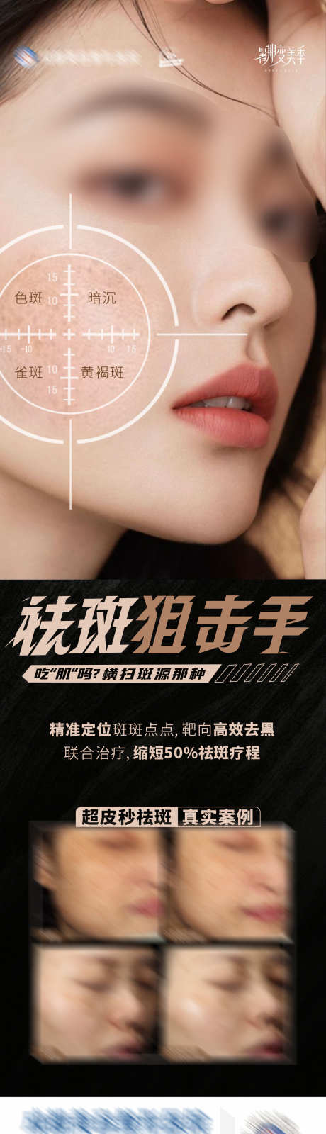 医美美业祛斑狙击手案例创意海报_源文件下载_1284X4664像素-黄褐斑,雀斑,色斑,对比,案例,祛斑,品牌,海报,高端,大气,质感,创意,美容,整形,美业,医院,医美-作品编号:2024102713578353-志设-zs9.com