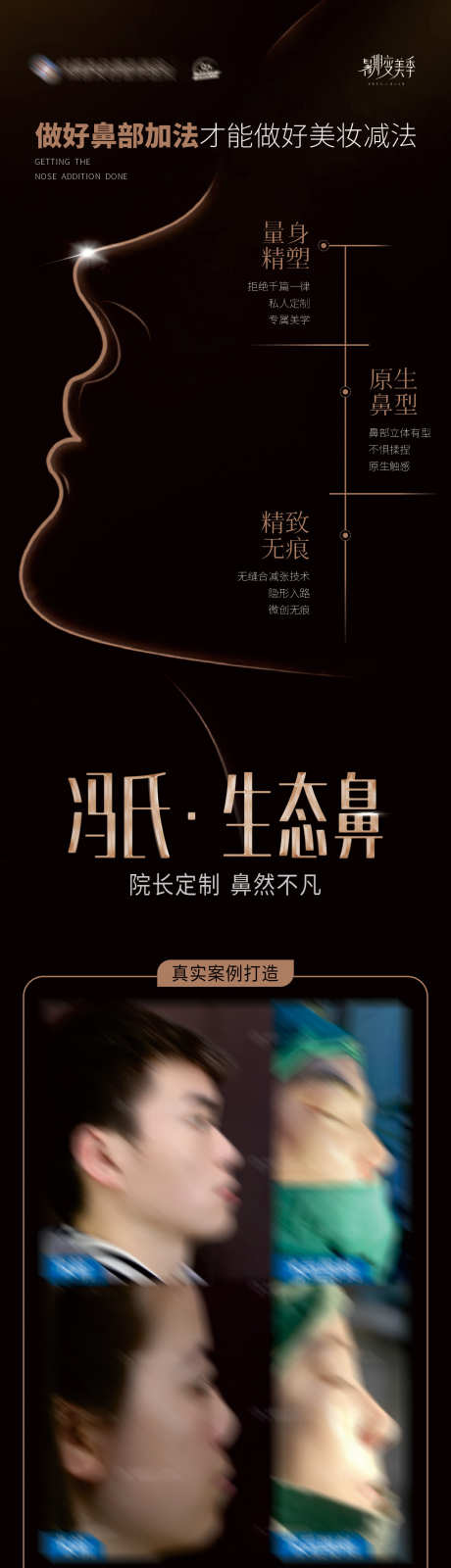 冯氏生态鼻创意海报_源文件下载_CDR格式_1284X4919像素-对比,案例,生态鼻,活动,福利,美鼻,面诊,专家,隆鼻,品牌,海报,模特,高端,大气,质感,创意,美容,整形,美业,医院,医美-作品编号:2024102716292604-志设-zs9.com