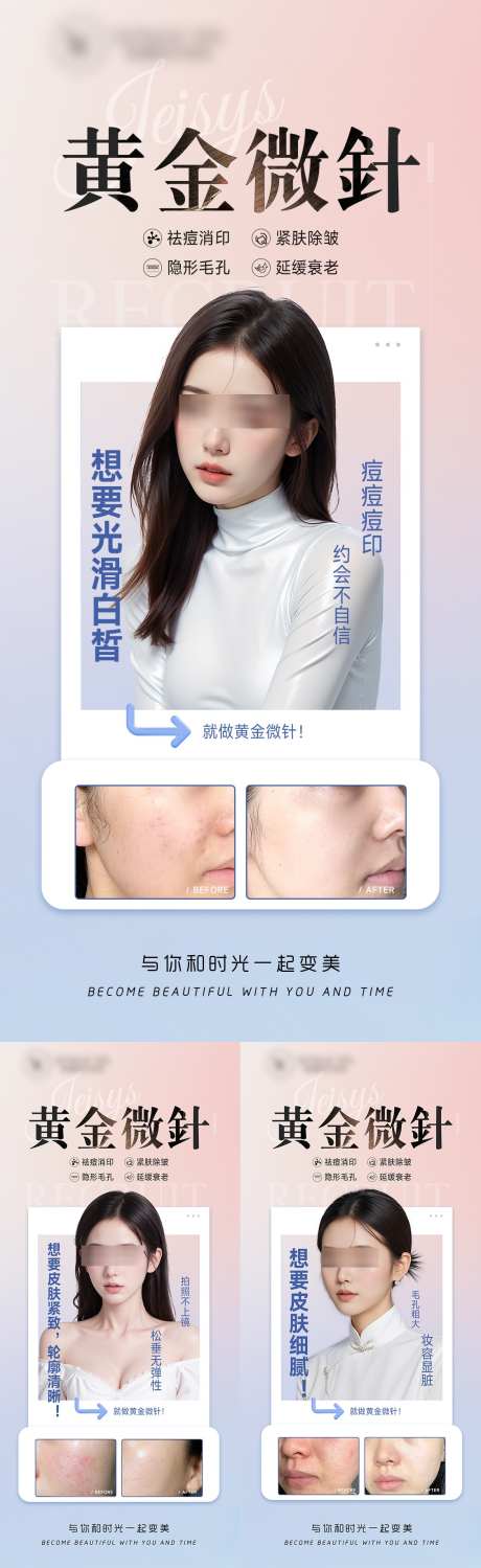 医美黄金微针案例海报_源文件下载_23格式_1125X3666像素-美容,案例,医美-作品编号:2024102808548336-志设-zs9.com