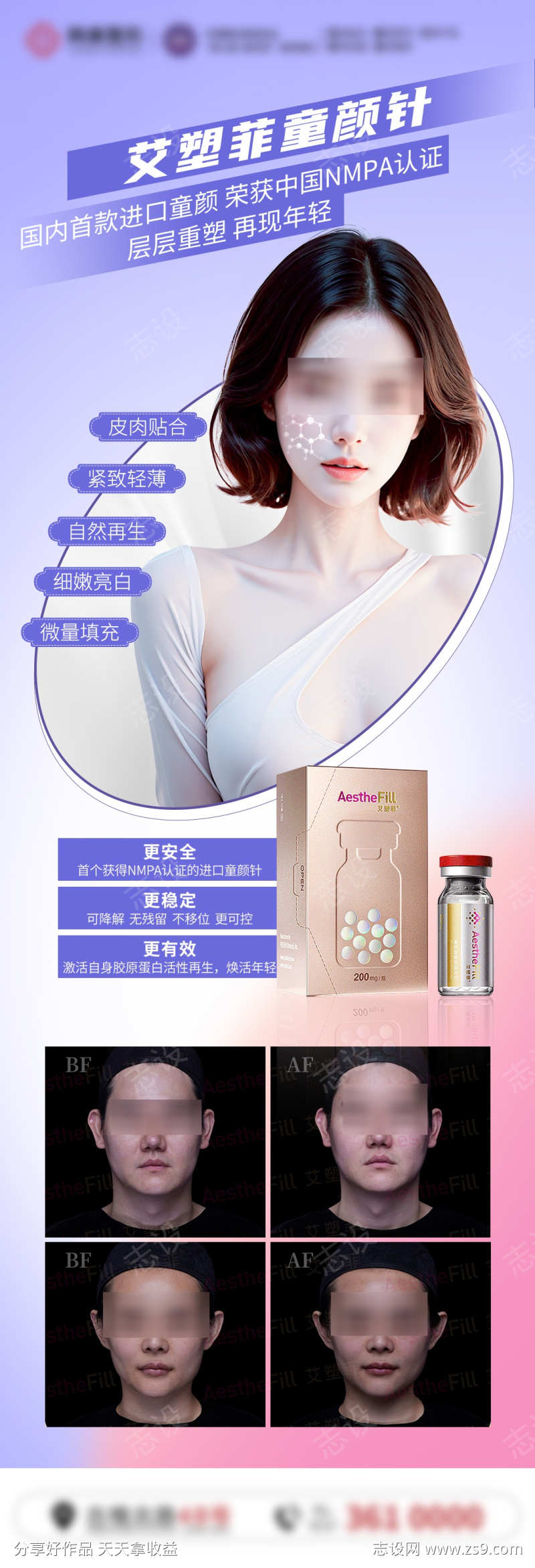 艾塑菲童颜针