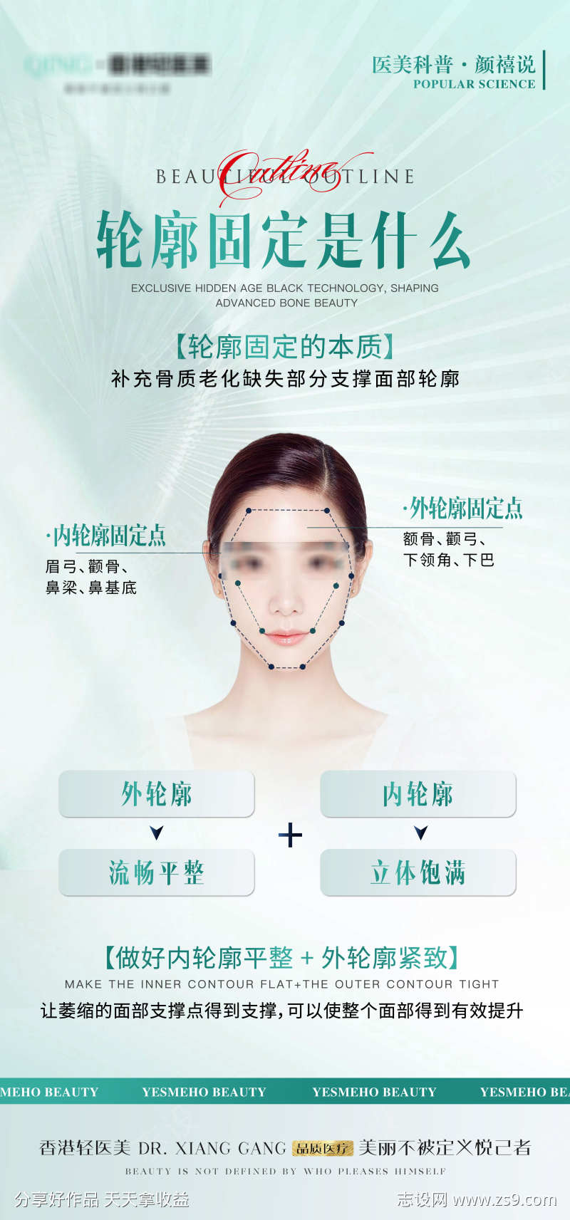 轮廓固定式什么