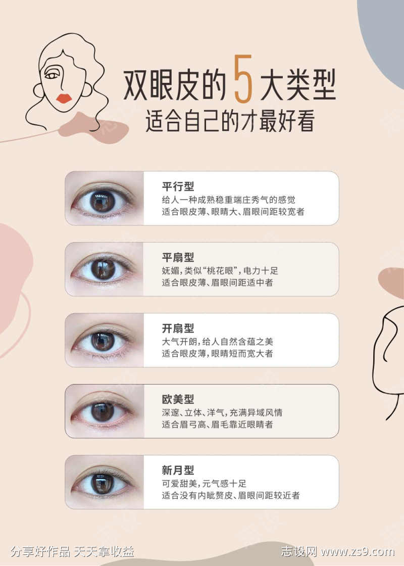 医美眼部整形双眼皮的5大类型普宣传画框