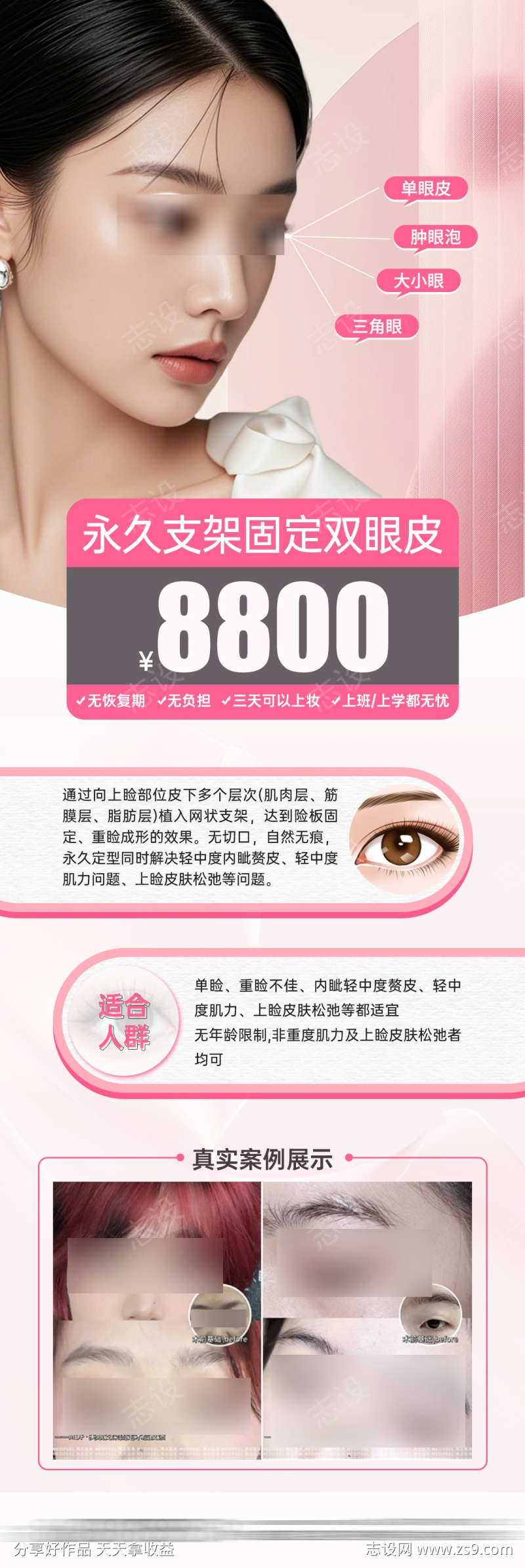 医美双眼皮整形项目卡海报