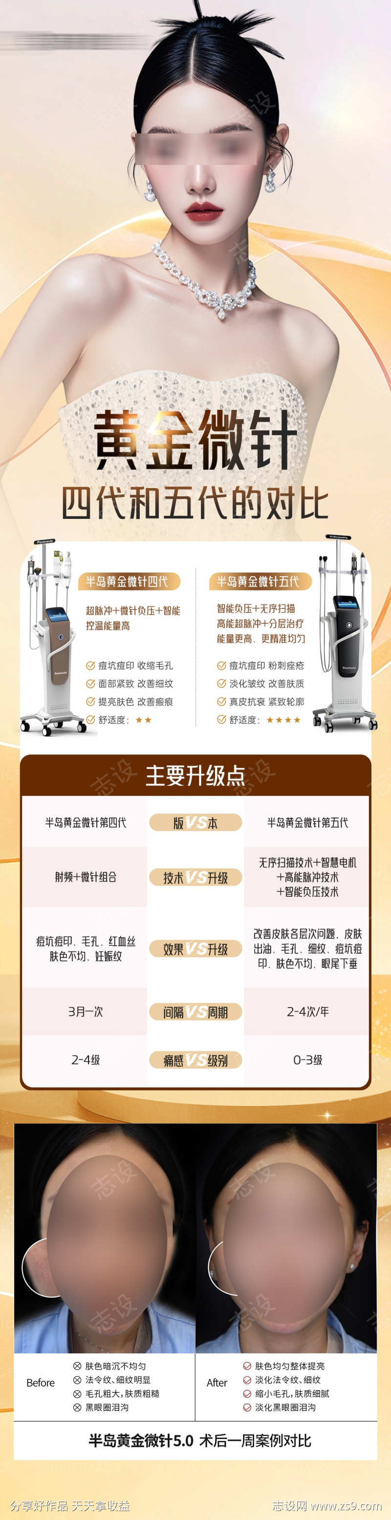 医美黄金微针4代5代对比案列海报