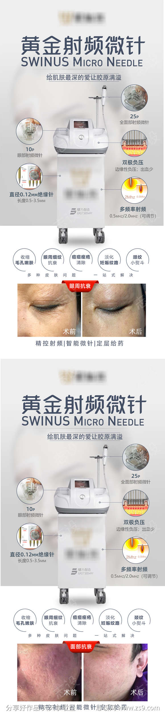 黄金射频微针海报
