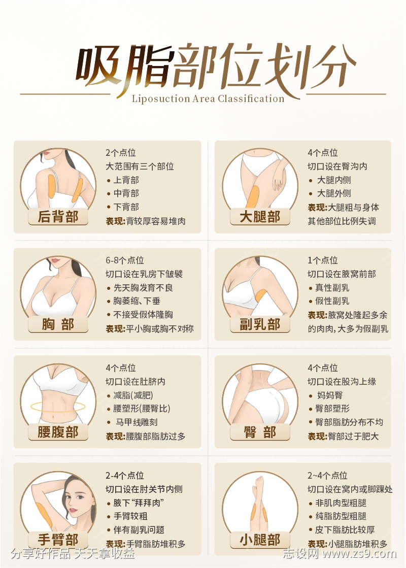 医美吸脂部位划分科普画框海报