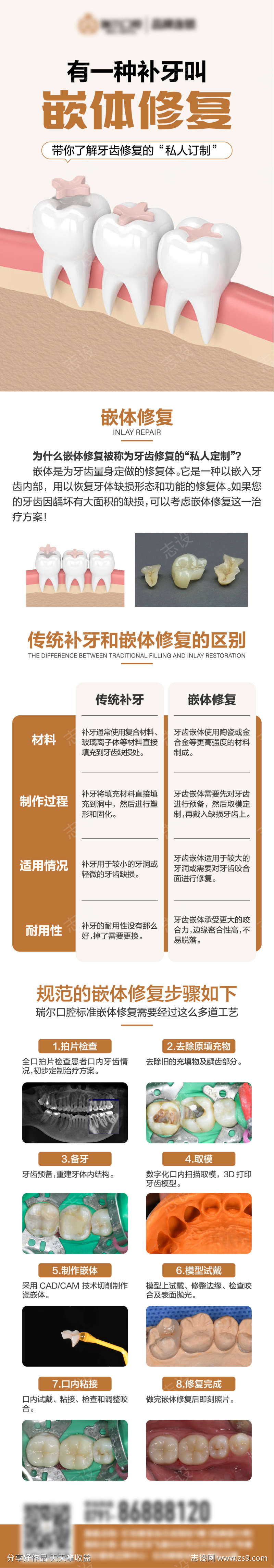 嵌体修复详情页