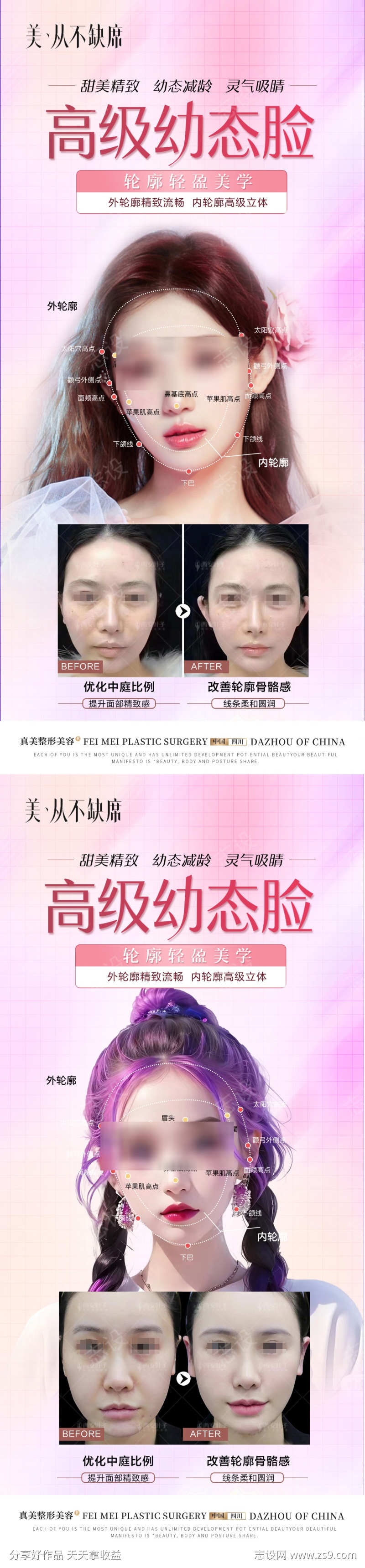 医美幼态脸案例活动系列海报