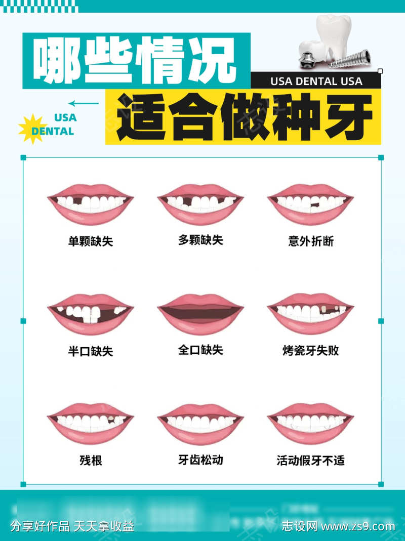哪些情况适合做种植牙