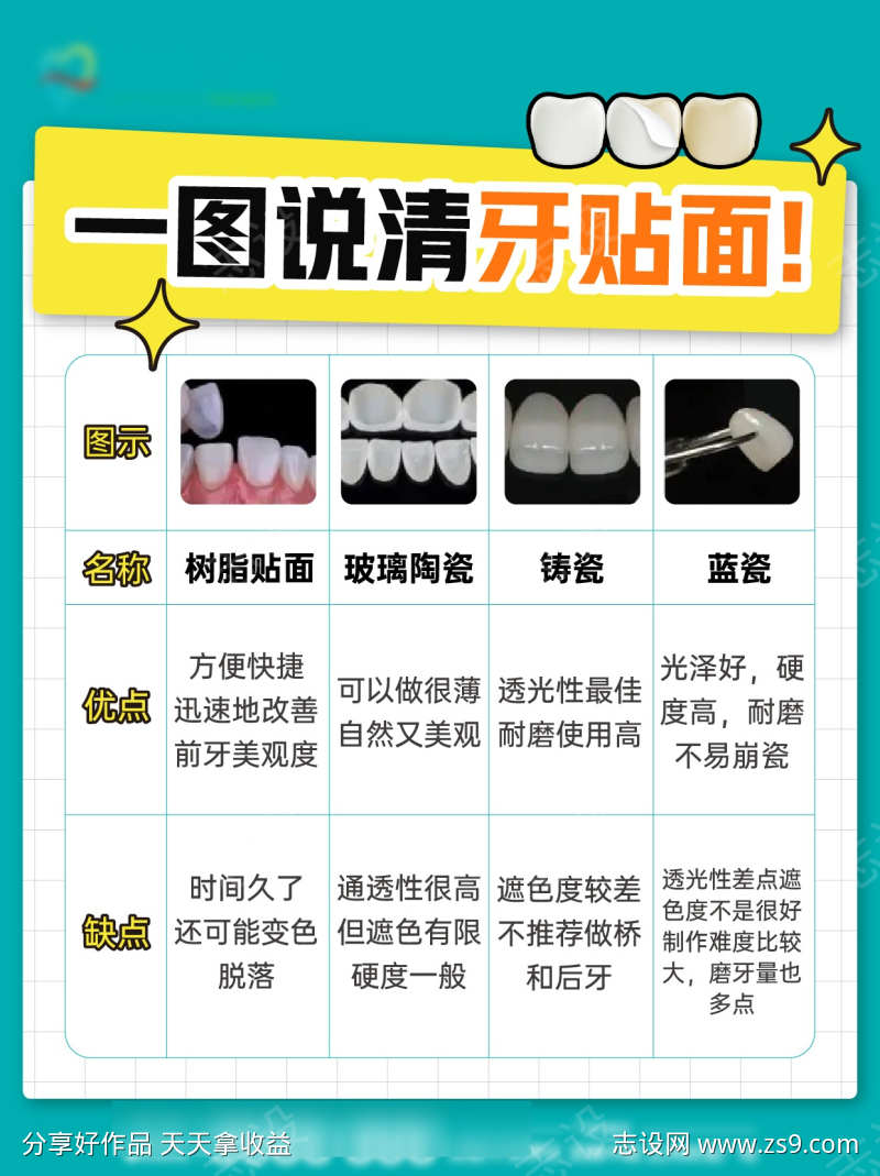 一图说清牙贴面