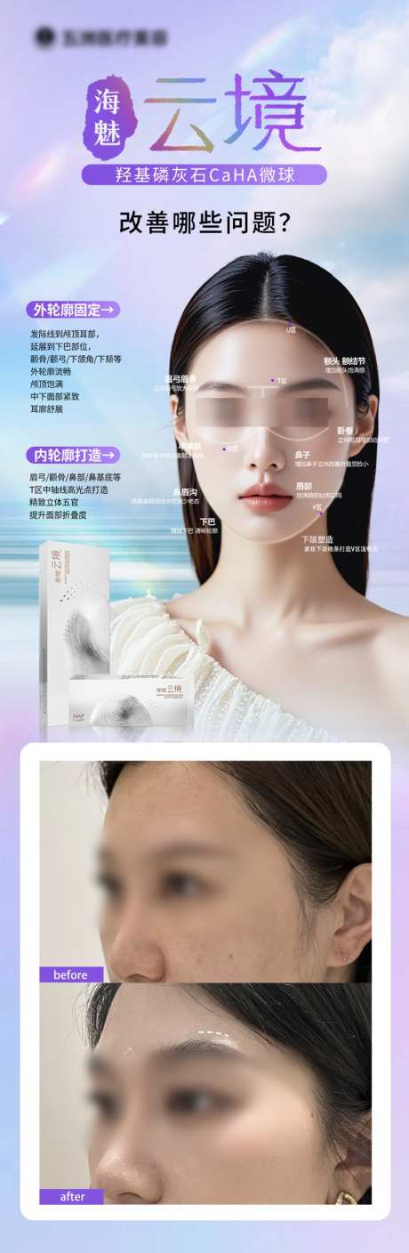 海媚云镜案例_源文件下载_PSD格式_797X2440像素-长图,案例,美容-作品编号:2024122411577002-志设-zs9.com