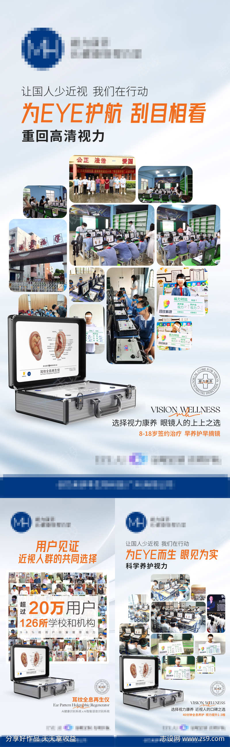眼近视案例
