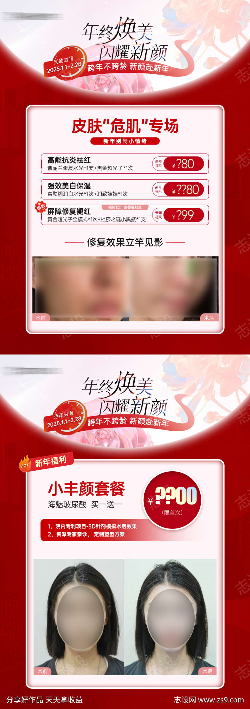 医美项目活动案例