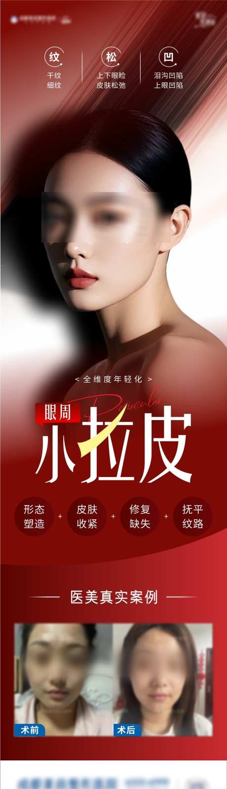 眼部小拉皮海报_源文件下载_CDR格式_1071X3875像素-抗衰,长图,模特-作品编号:2025020713263157-志设-zs9.com