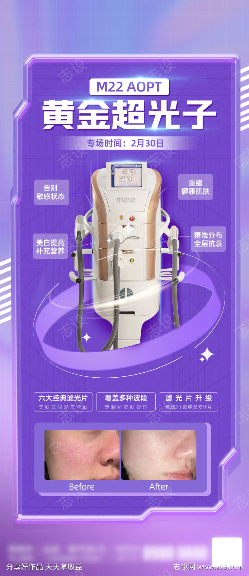 M22aopt黄金超光子