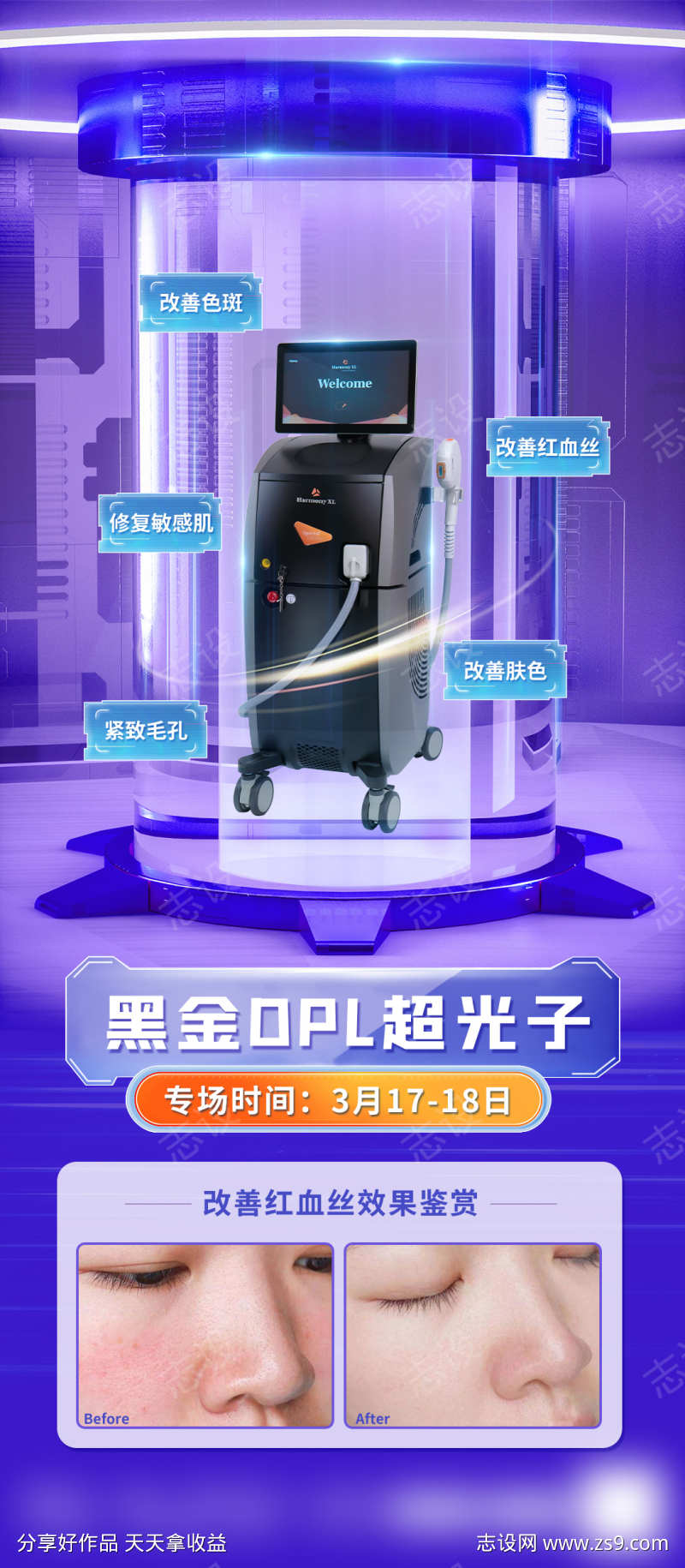 黑金dpl超光子