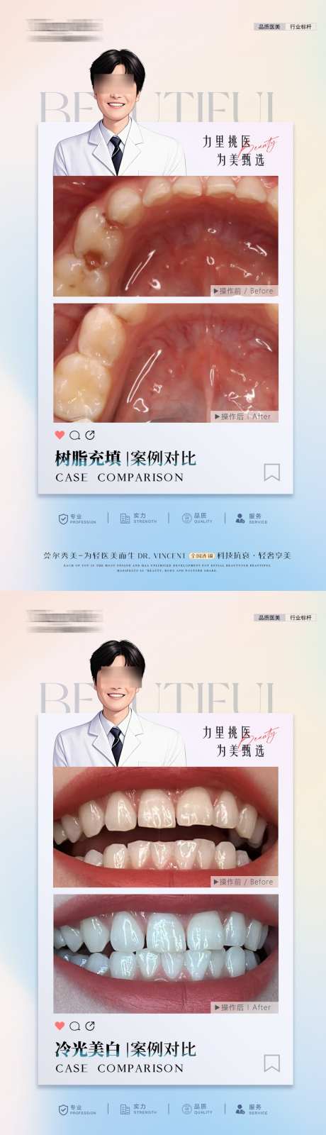 口腔案例海报_源文件下载_PSD格式_1080X3905像素-牙科,案例,简介-作品编号:2025021416043761-志设-zs9.com