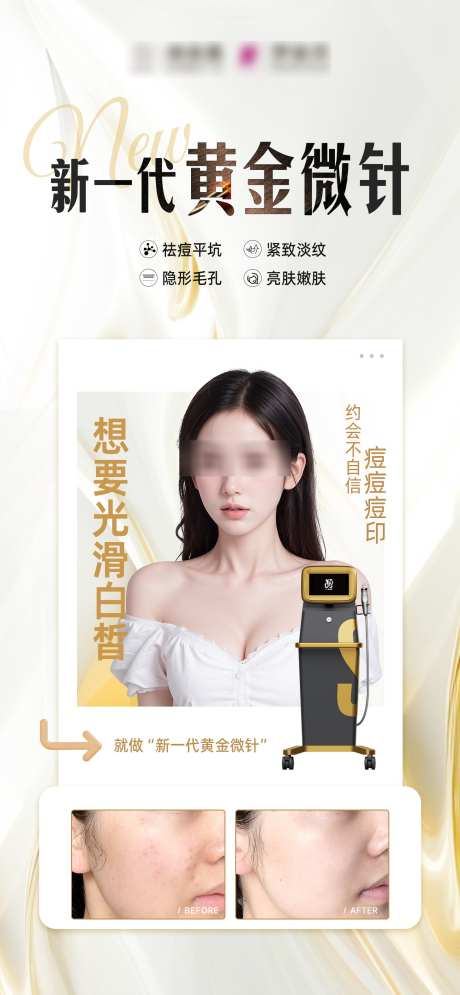 新一代黄金微针案例_源文件下载_PSD格式_1457X3150像素-高级,质感,痘印-作品编号:2025021913473915-志设-zs9.com