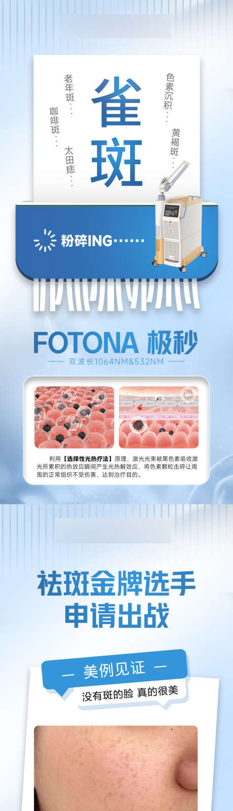 fotona极秒_源文件下载_PSD格式_1049X4535像素-仪器,案例,对比-作品编号:2025022114398323-志设-zs9.com