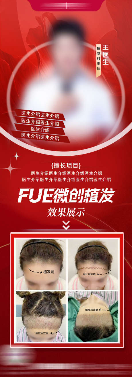 fue植发医生海报_源文件下载_PSD格式_1077X3063像素-植发,海报,案例-作品编号:2025022410403812-志设-zs9.com