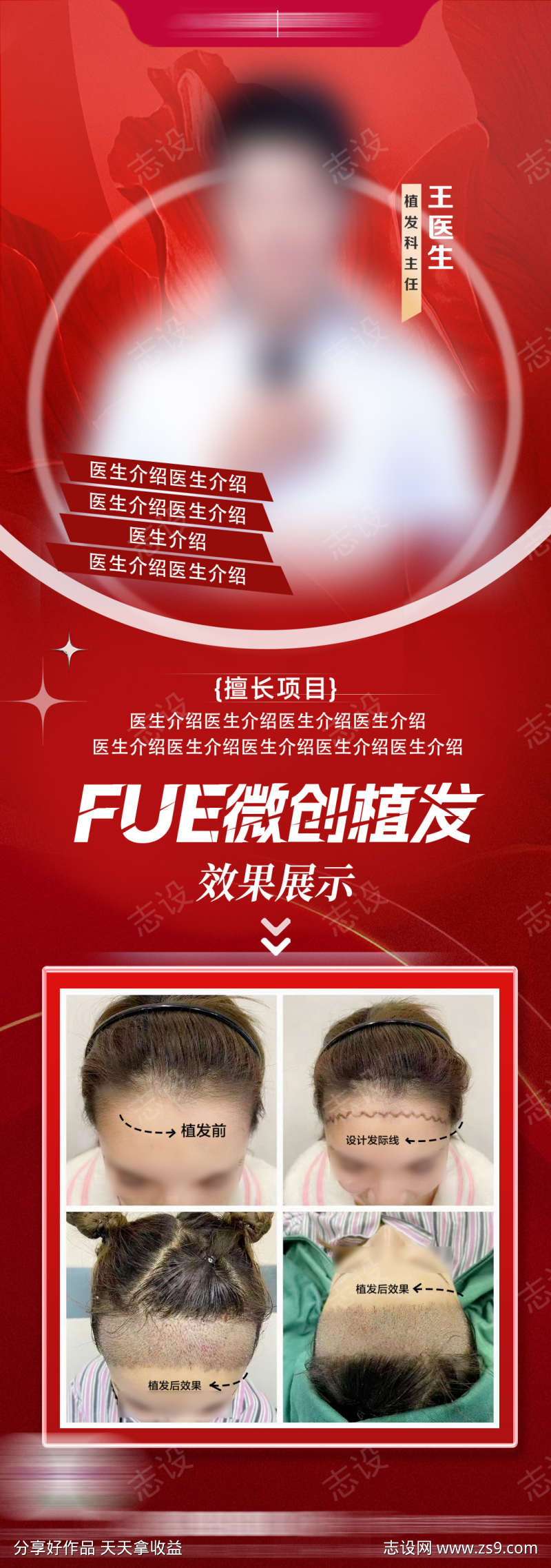 fue植发医生海报