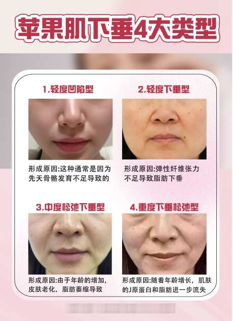 医美活动主题卡项海报封面科普_源文件下载_PSD格式_1080X1484像素-美妆,活动,海报-作品编号:2025022409509209-志设-zs9.com