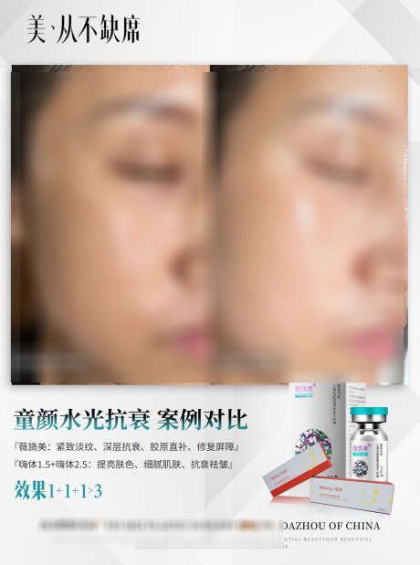 童颜水光抗衰案例_源文件下载_PSD格式_2362X3179像素-抗衰,童颜,美容-作品编号:2025022509373333-志设-zs9.com