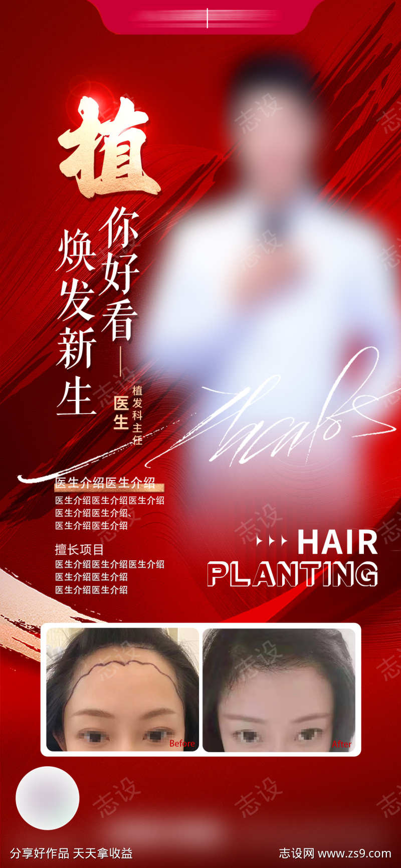 医生植发介绍海报