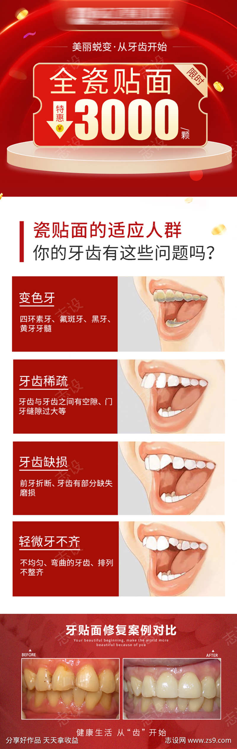 口腔刷屏稿