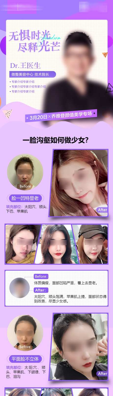 玻尿酸面部填充长图海报_源文件下载_PSD格式_750X3263像素-活动,案例,海报-作品编号:2025030115537082-志设-zs9.com