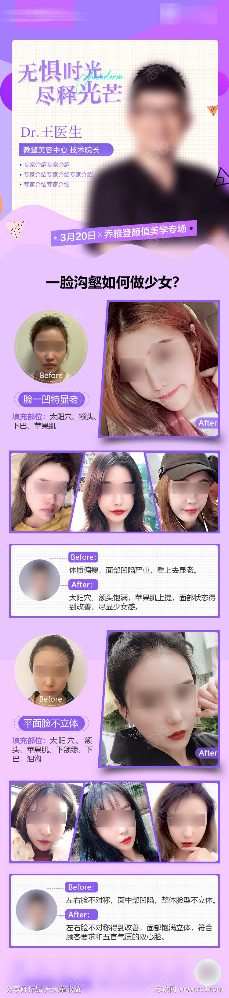 玻尿酸面部填充长图海报