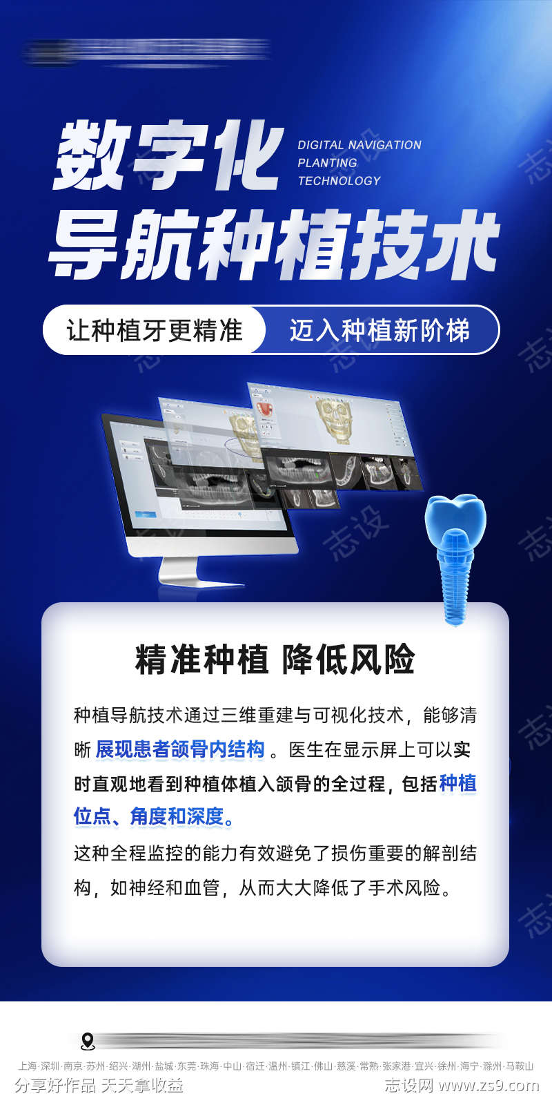 数字化导航导板种植