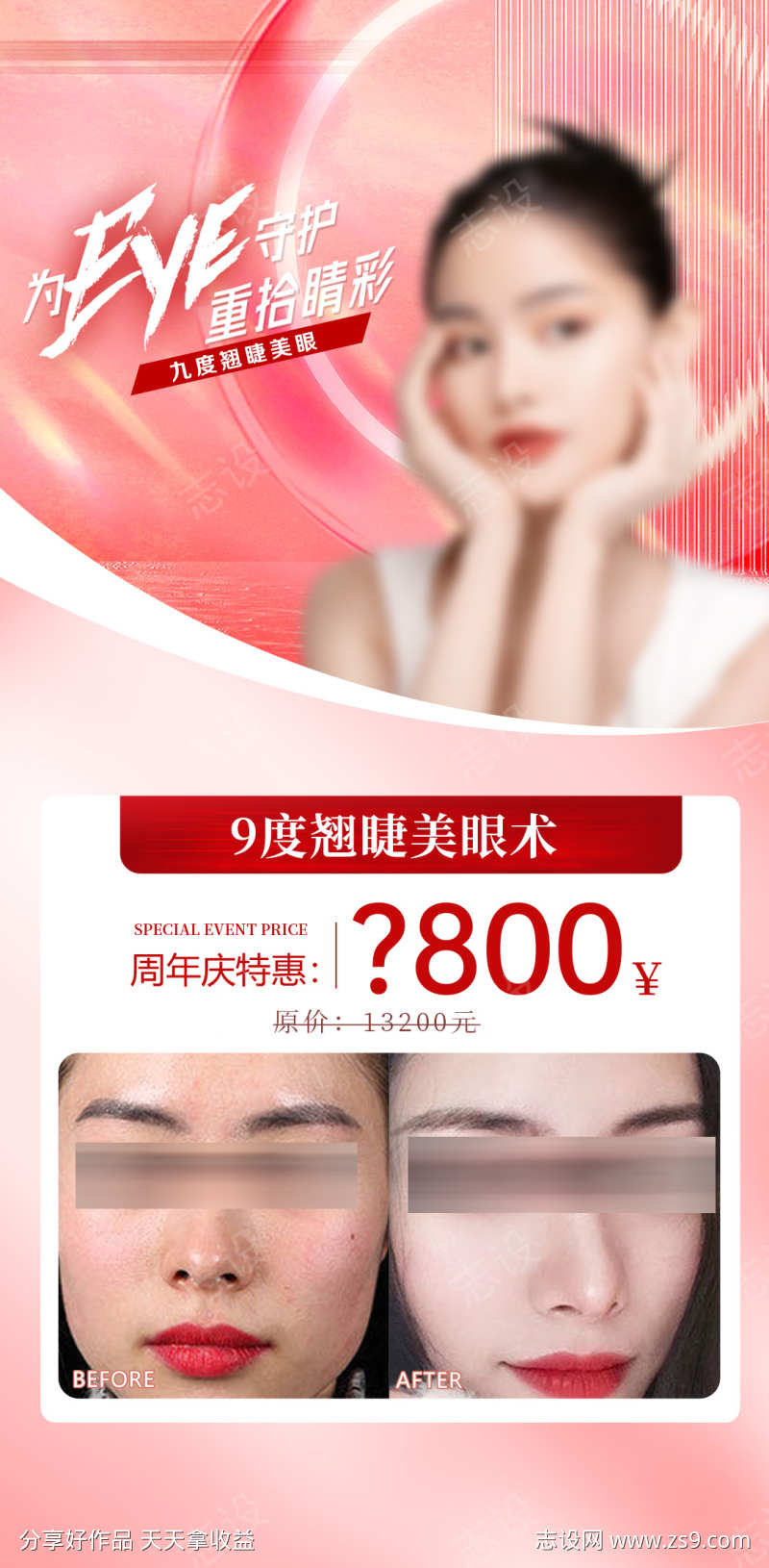 眼综合案例海报
