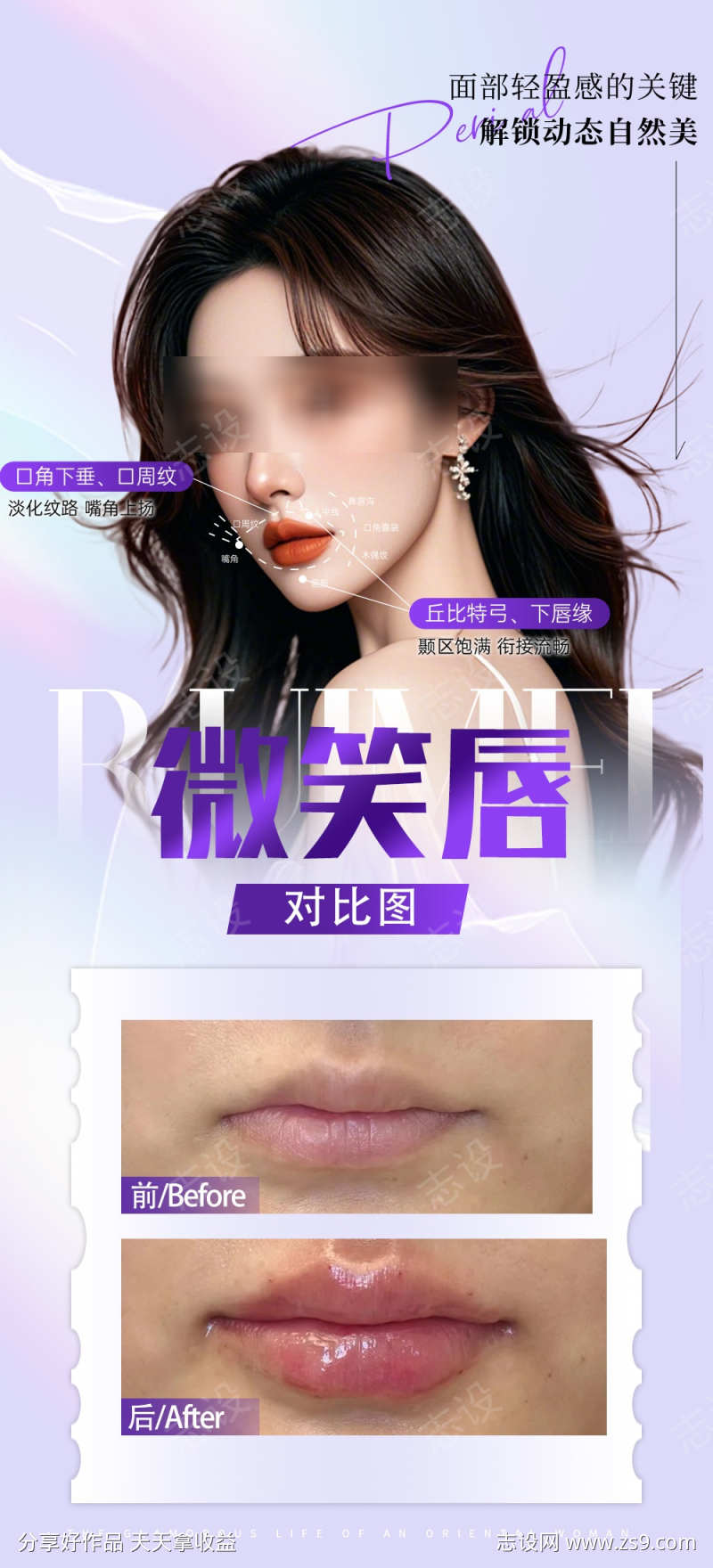 微笑唇对比图