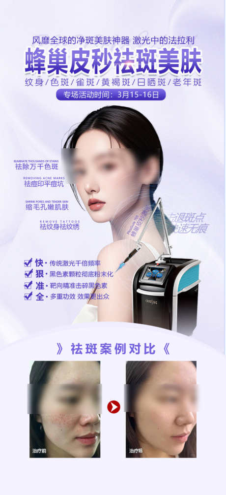 医美皮秒祛斑活动案例海报_源文件下载_PSD格式_750X1639像素-人物,抗衰,美容-作品编号:2025031014348616-志设-zs9.com