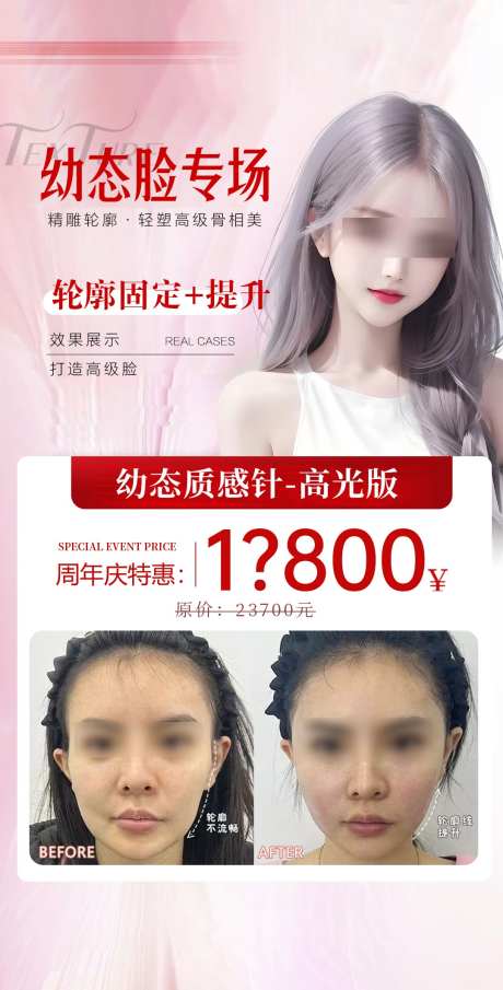 幼态脸注射案例海报_源文件下载_PSD格式_1080X2124像素-固定,玻尿酸,填充-作品编号:2025031014344811-志设-zs9.com