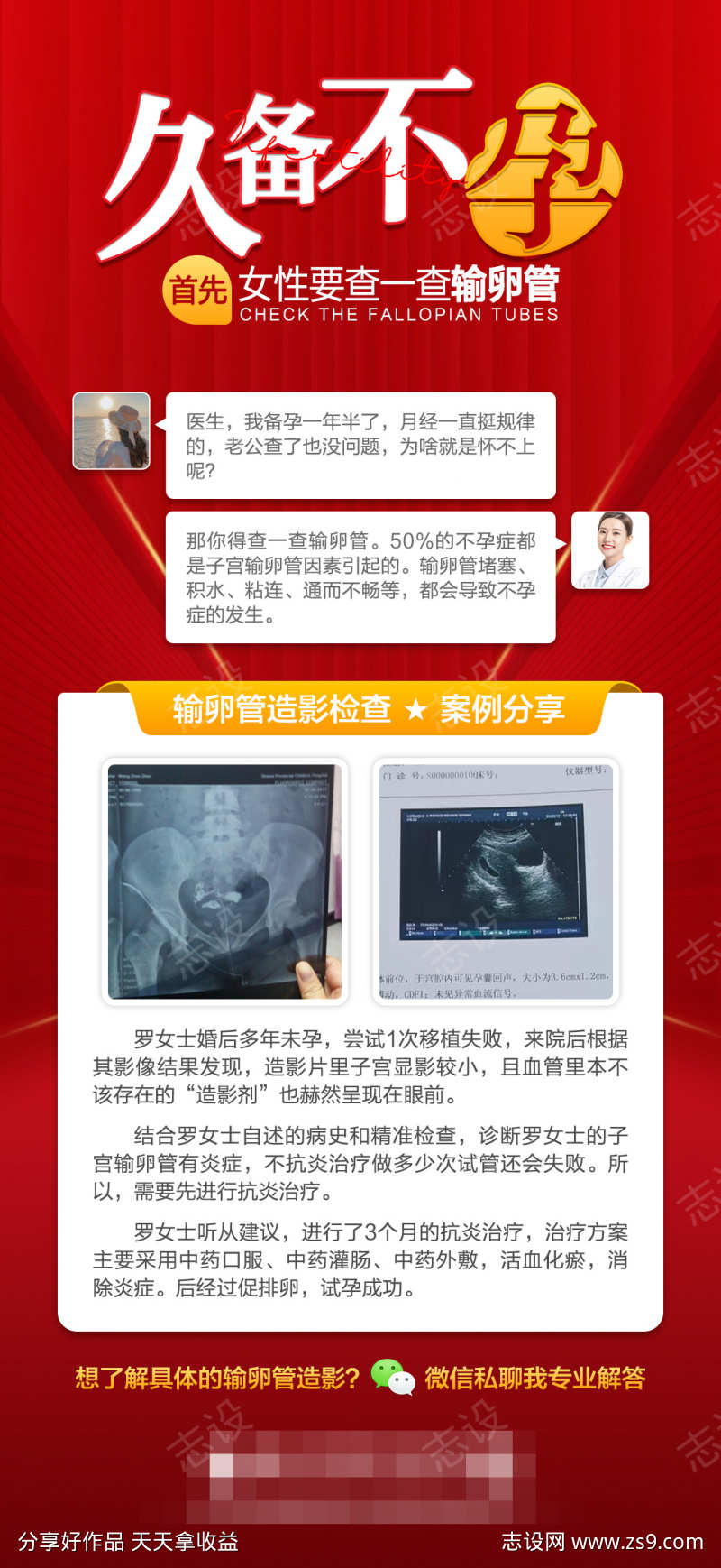 久备不孕输卵管