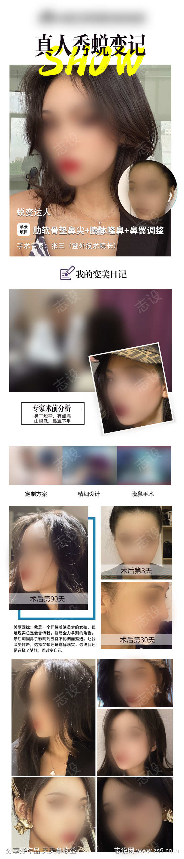 模特隆鼻案例打版长图